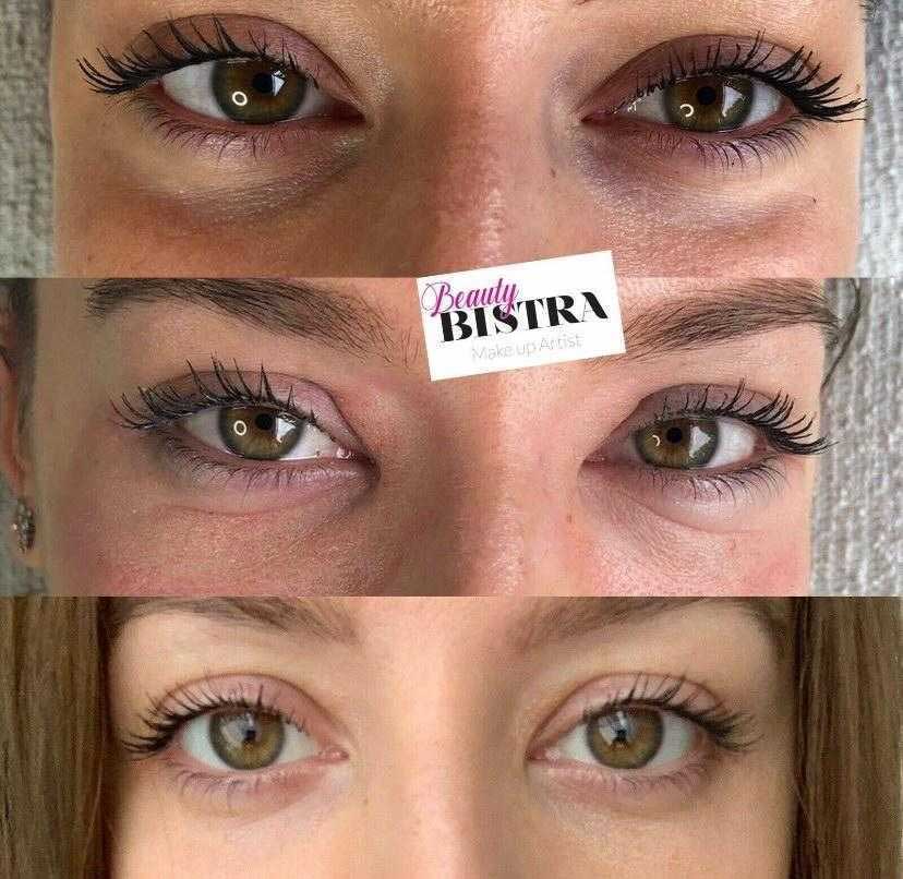 Permanent Concealer Before and After Pictures Gallery Permanent Concealer Before and After Pictures Gallery