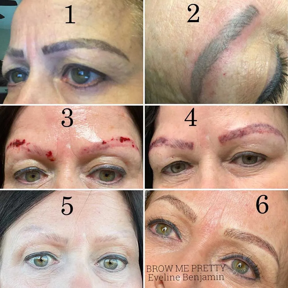 What are the Physical Consequences of Bad Microblading?