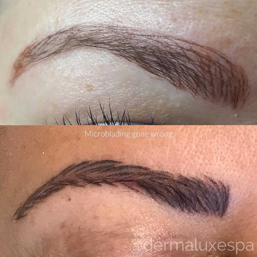 Microblading Gone Wrong: What’s Good to Know?