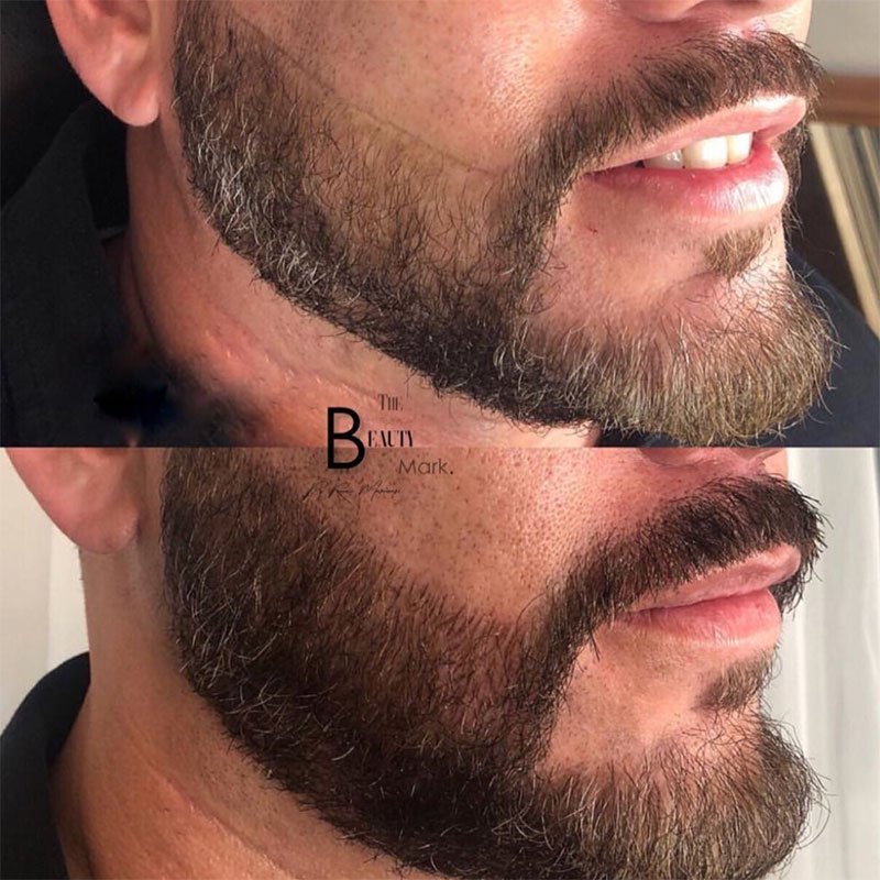 Men's Microblading Beard and Mustache: All You Need to Know