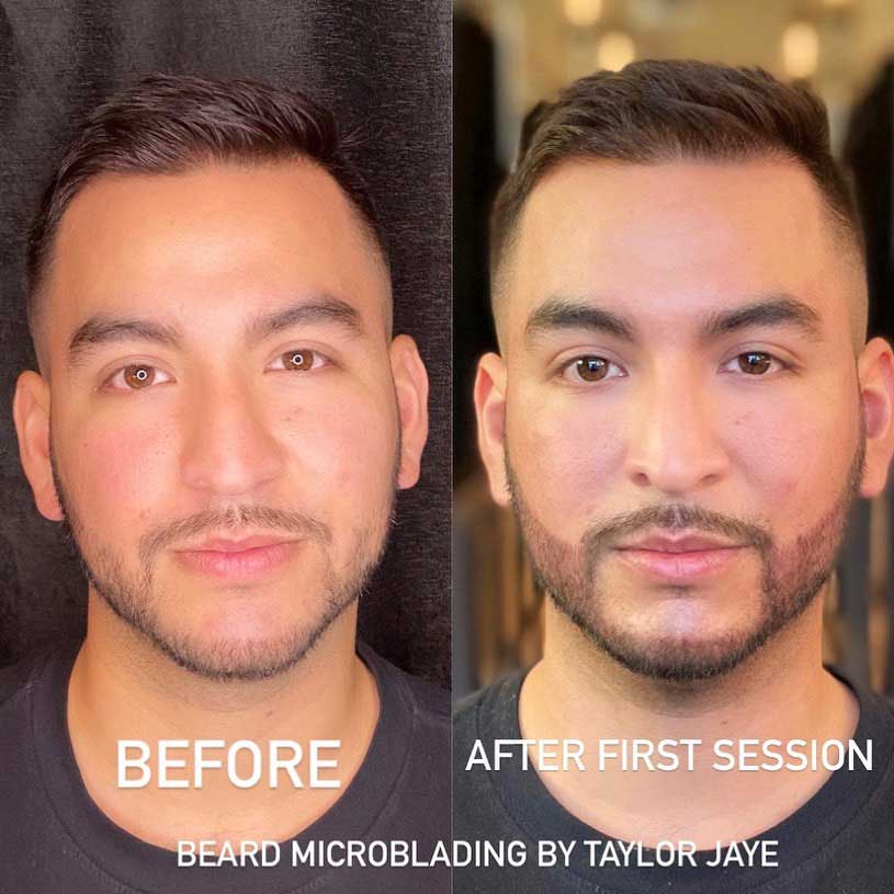 Microblading facial treatment for mustache and beard