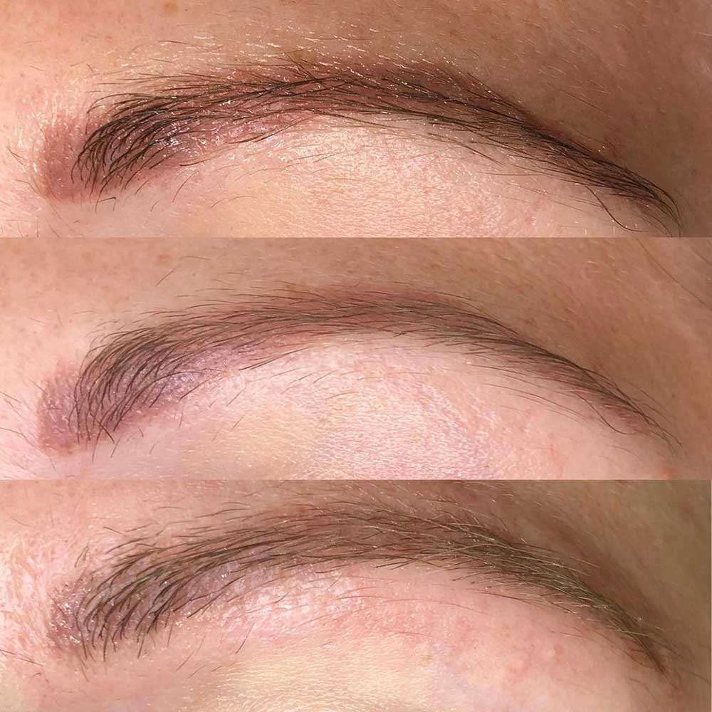 Powder Eyebrows Removal Before and After