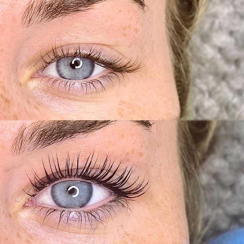 Who Is an Eyelash Lift For?