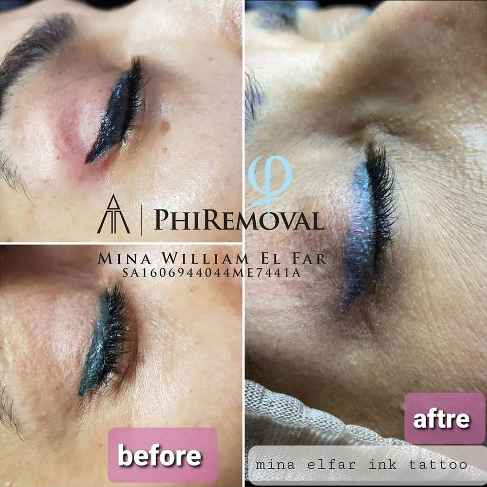 The Cosmetic Tattoo Studio  ELECTRIC BLUE EYELINER My client and I met  late last year to discuss the possibility of doing a beautiful winged  eyeliner tattoo in her every day eye