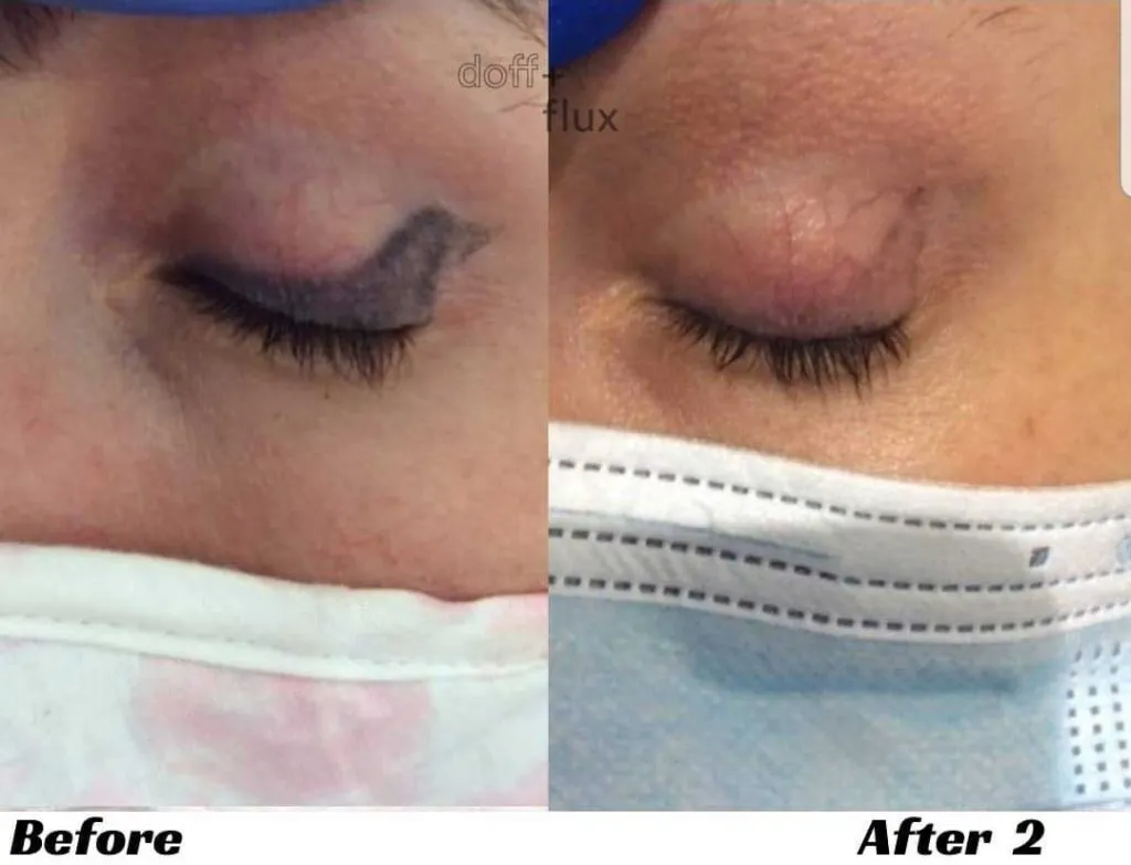 Permanent Eyeliner Aftercare Everything You Need to Know  Nicole Mansur  Artistry