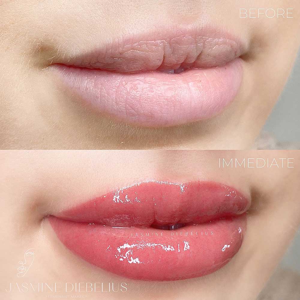 Lip Tattoo Before and After Gallery