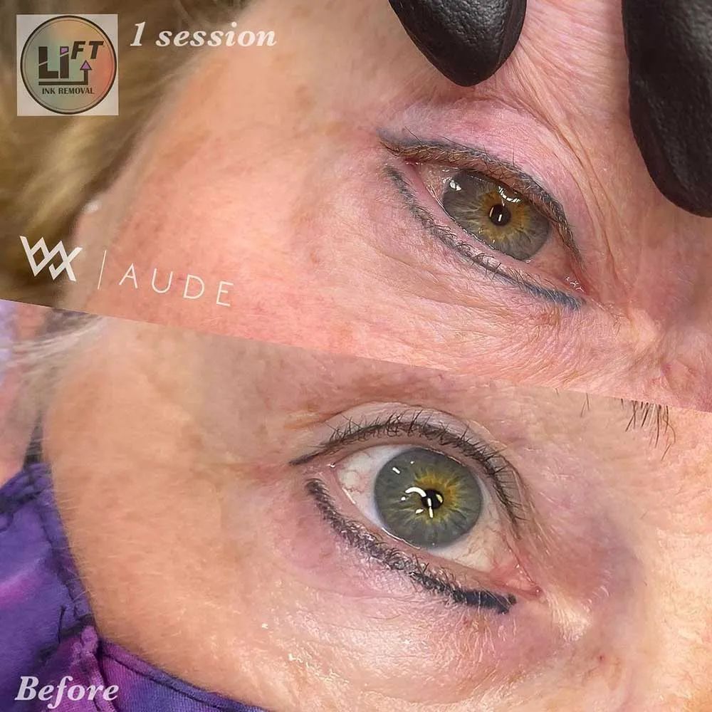 Replying to @newtothis23 why would you tattoo your eyeballs & risk so ... |  TikTok