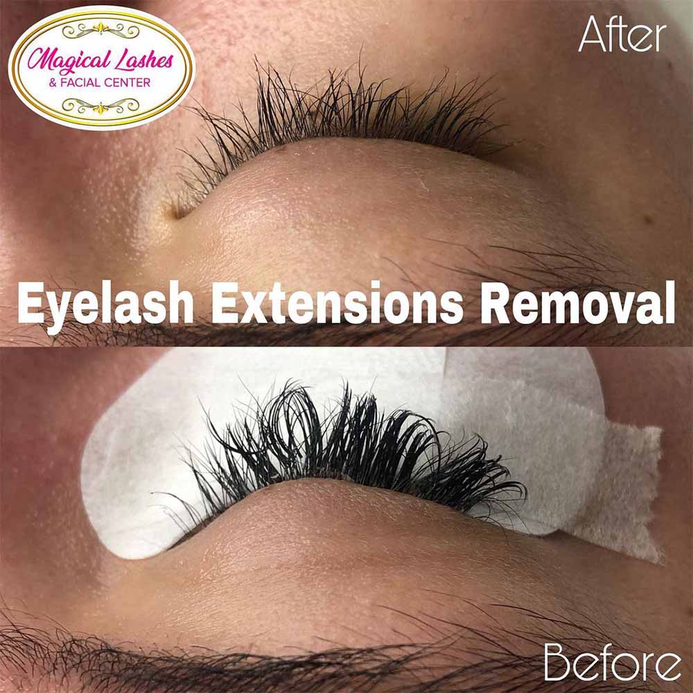 Reasons for Removing Eyelash Extensions