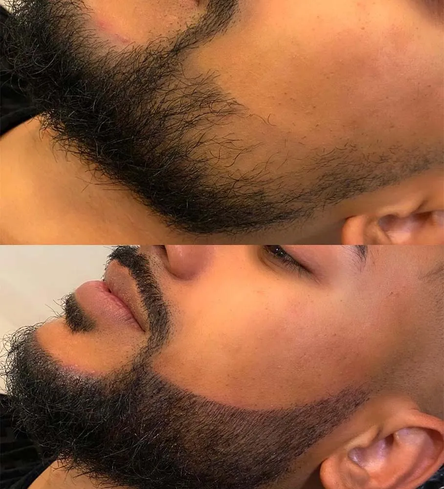 Cosmetic Beard Tattoo - PMU Solutions for Facial Hair Enhancement Cosmetic Beard Tattoo - PMU Solutions for Facial Hair Enhancement