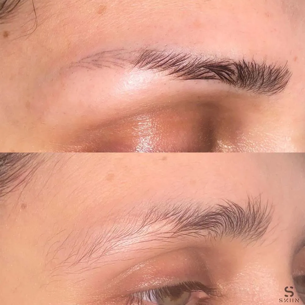 Nano Brows Removal