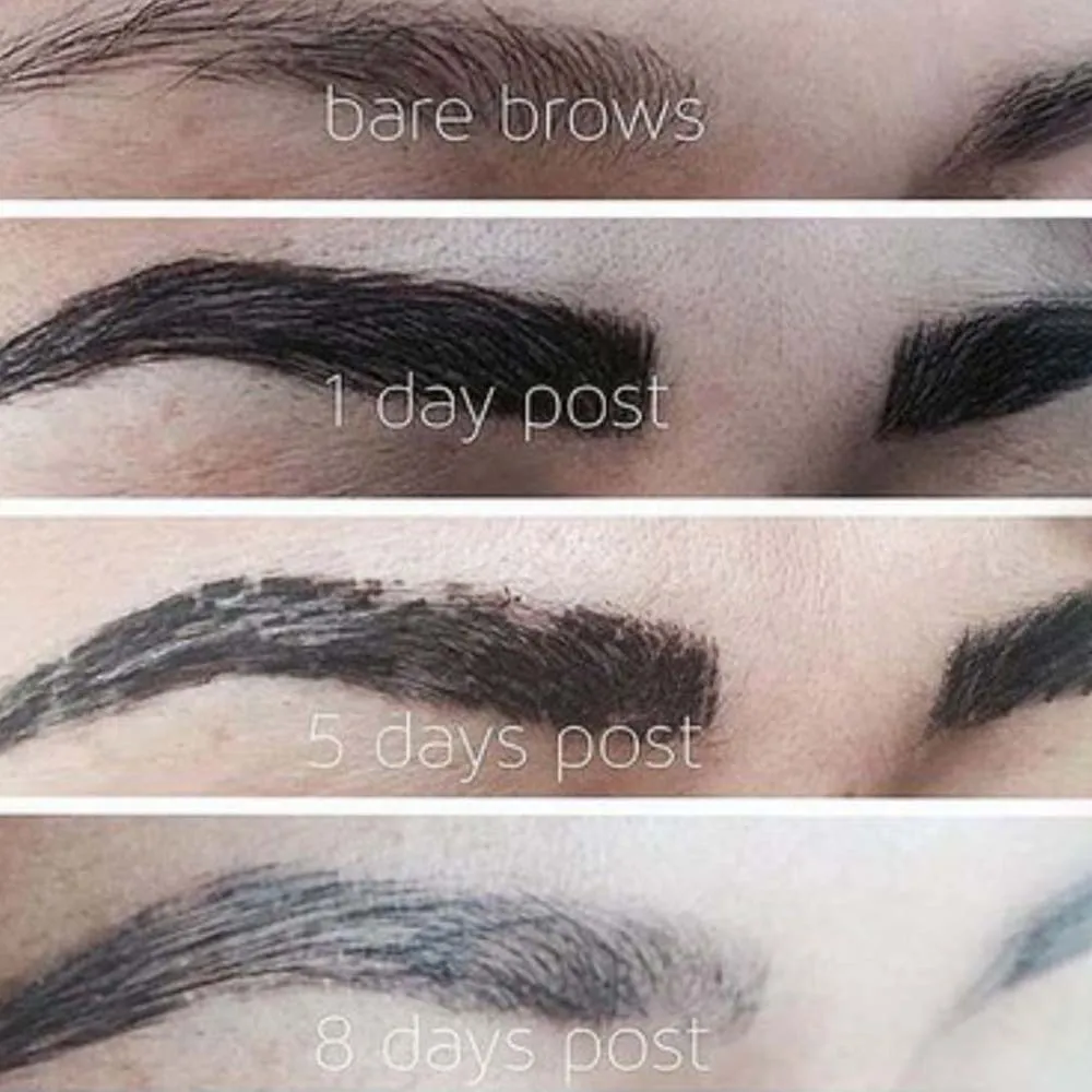 Are Itchy Eyebrows After Microblading Normal?