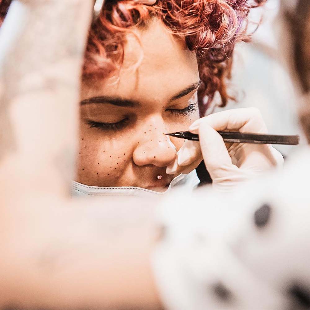Freckle Tattoo Treatment Process Step by Step
