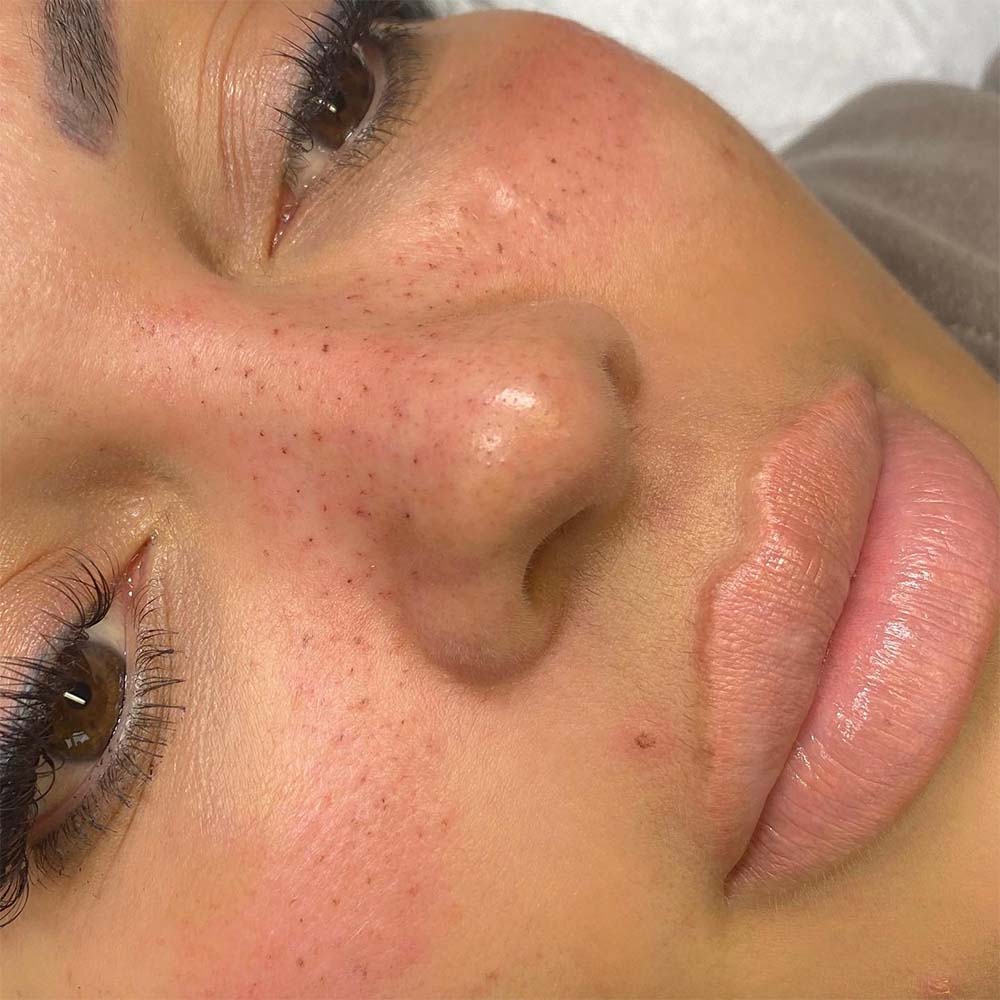 What’s the Freckle Tattoos Cost Range?