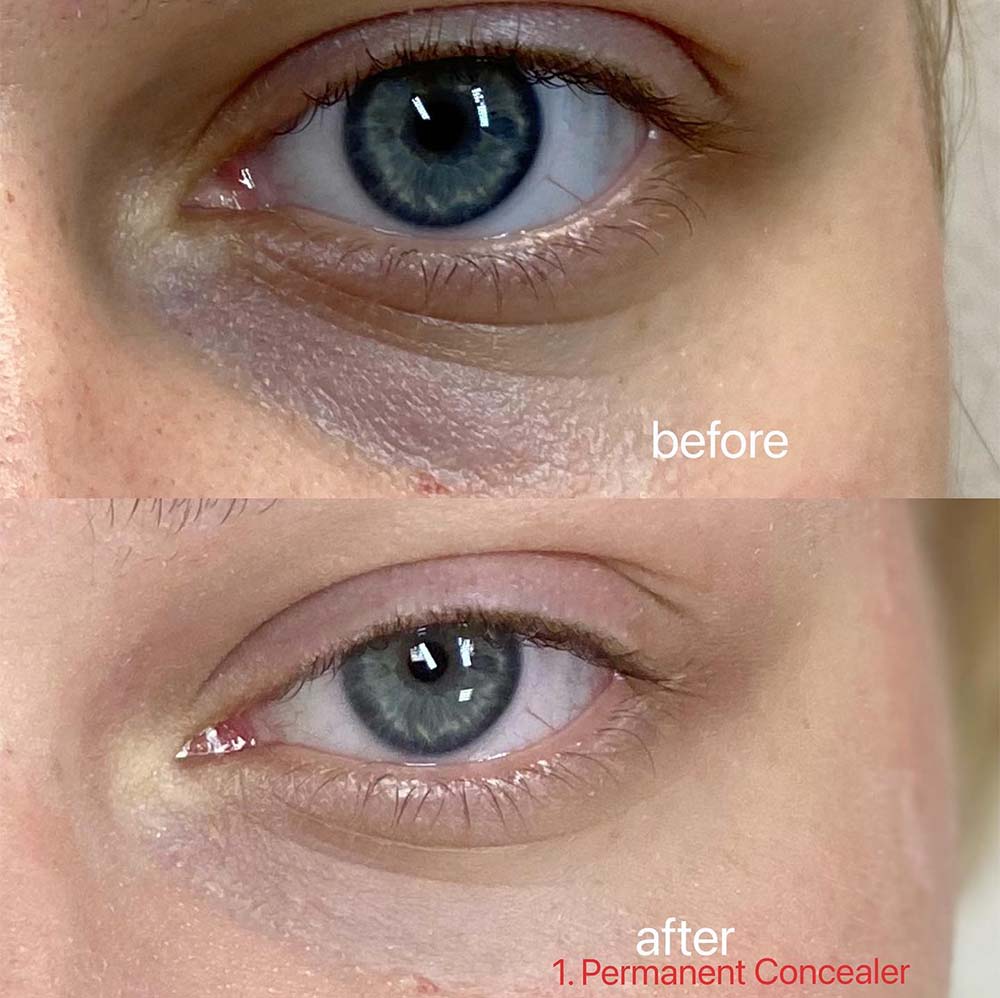 Permanent Concealer Tattoo: The Ultimate Guide to the Treatment
