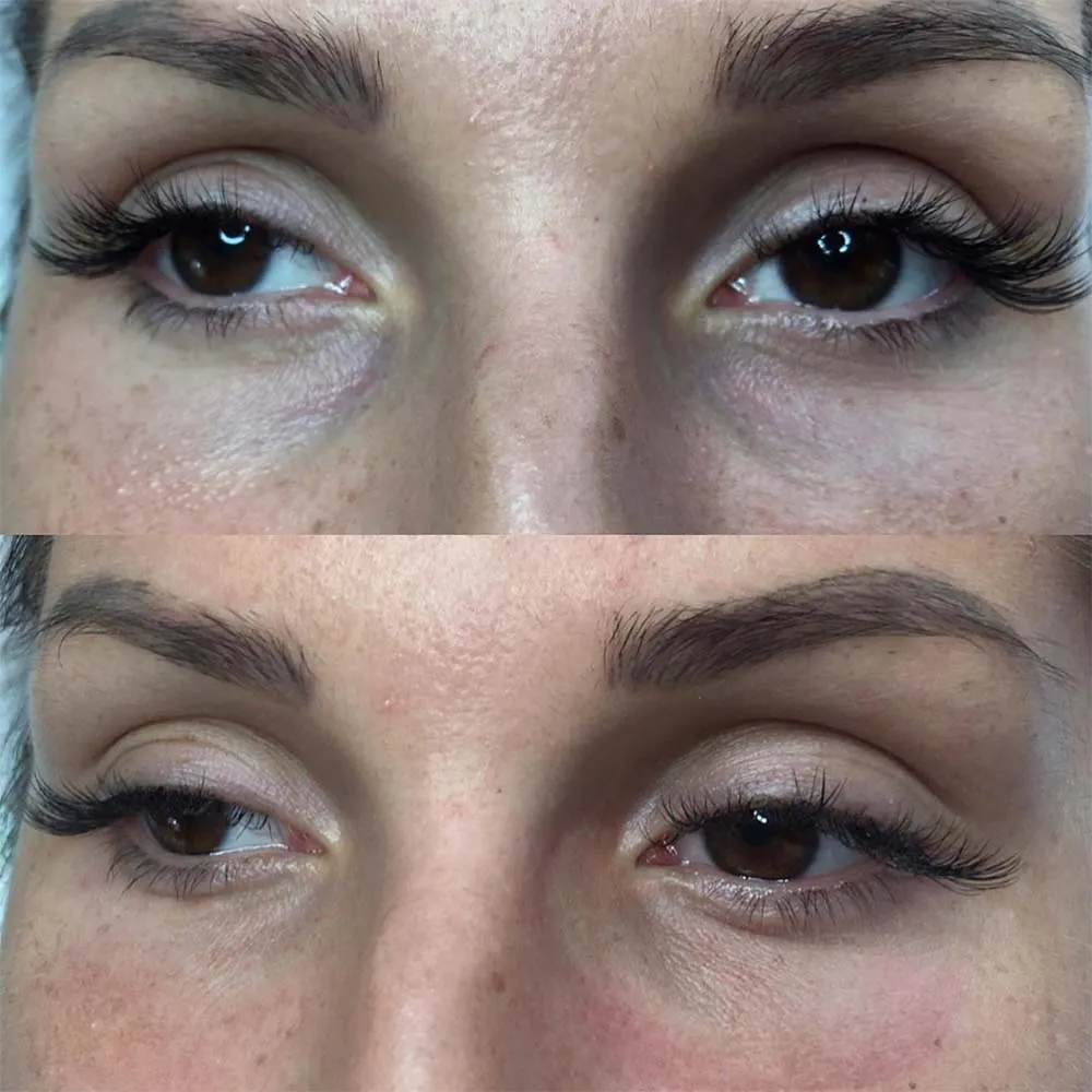 Permanent Concealer Tattoo The