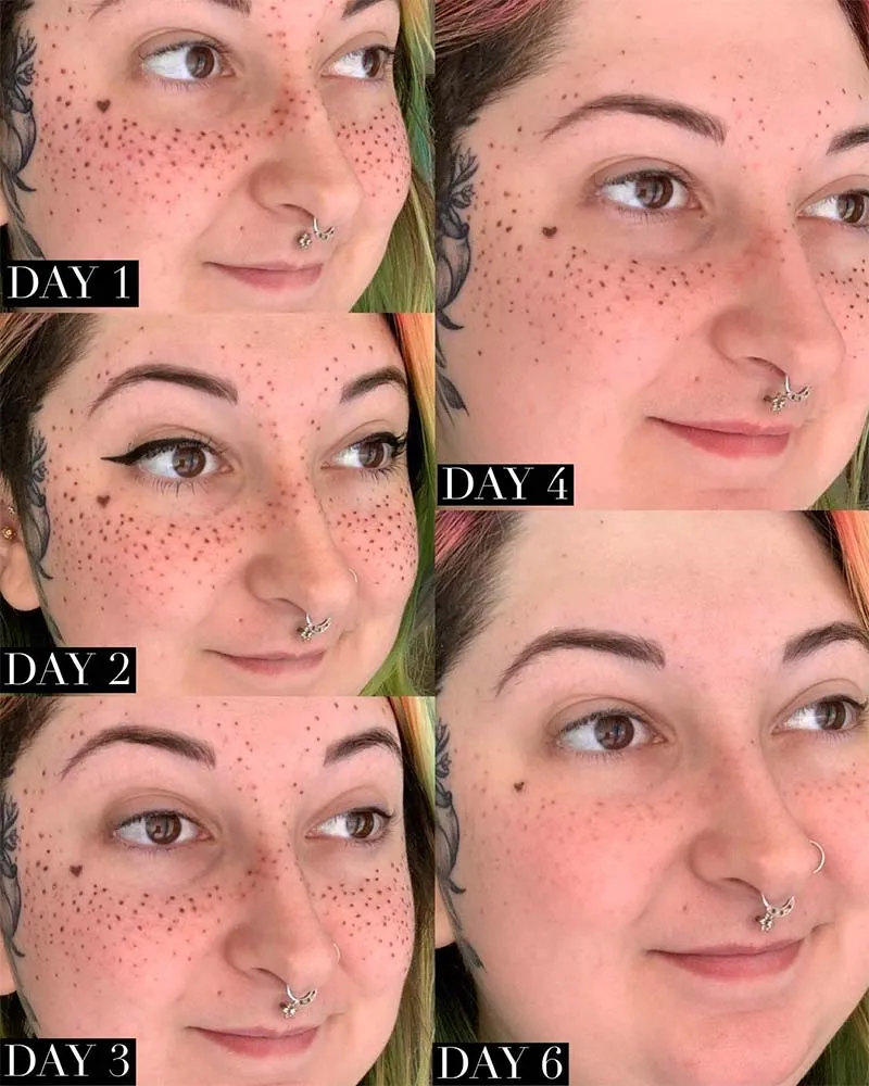 SemiPermanent Freckle Tattoos The Ultimate Guide