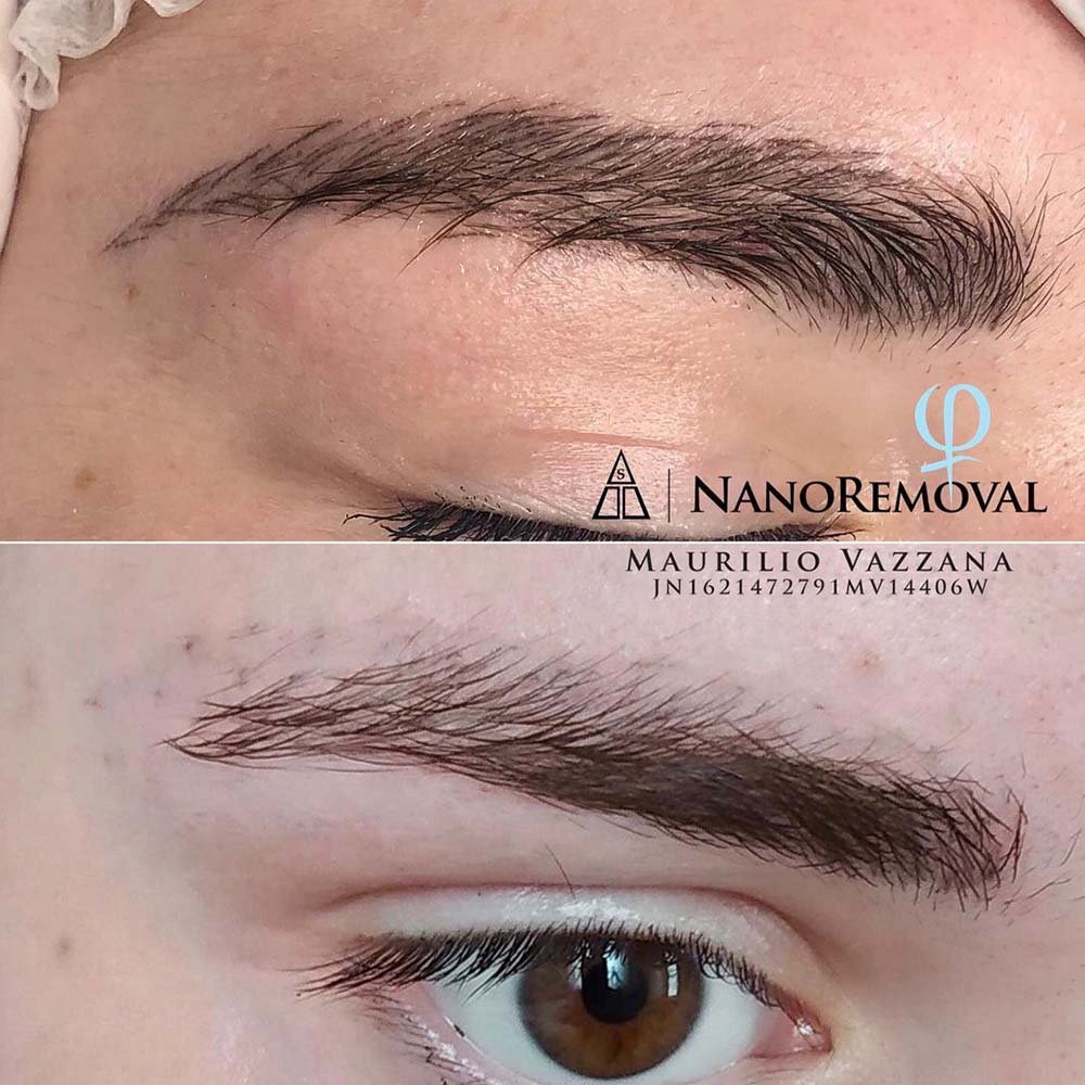 Microbladed Eyebrows Faded Wrong