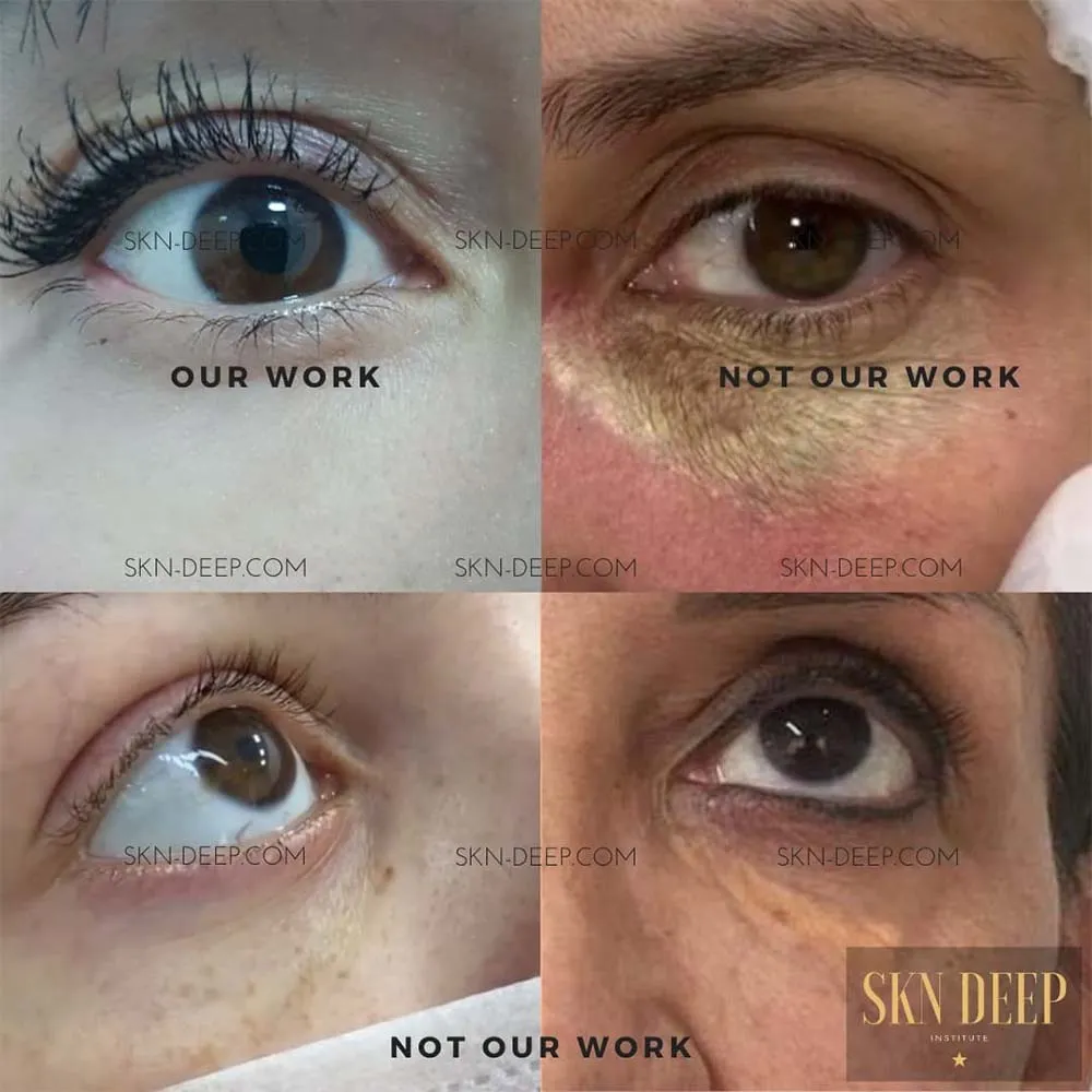 does under eye concealer tattoo work