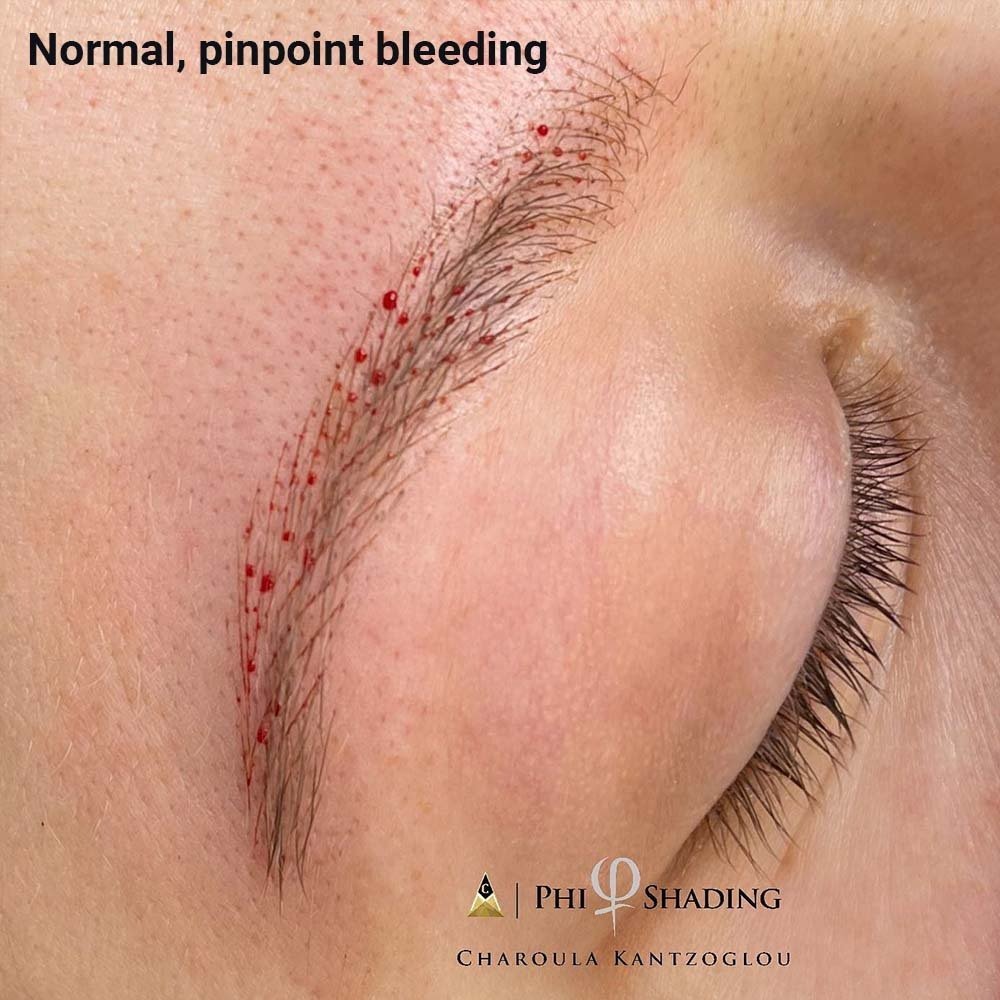 Normal, Pinpoint Bleeding During Microblading Treatment