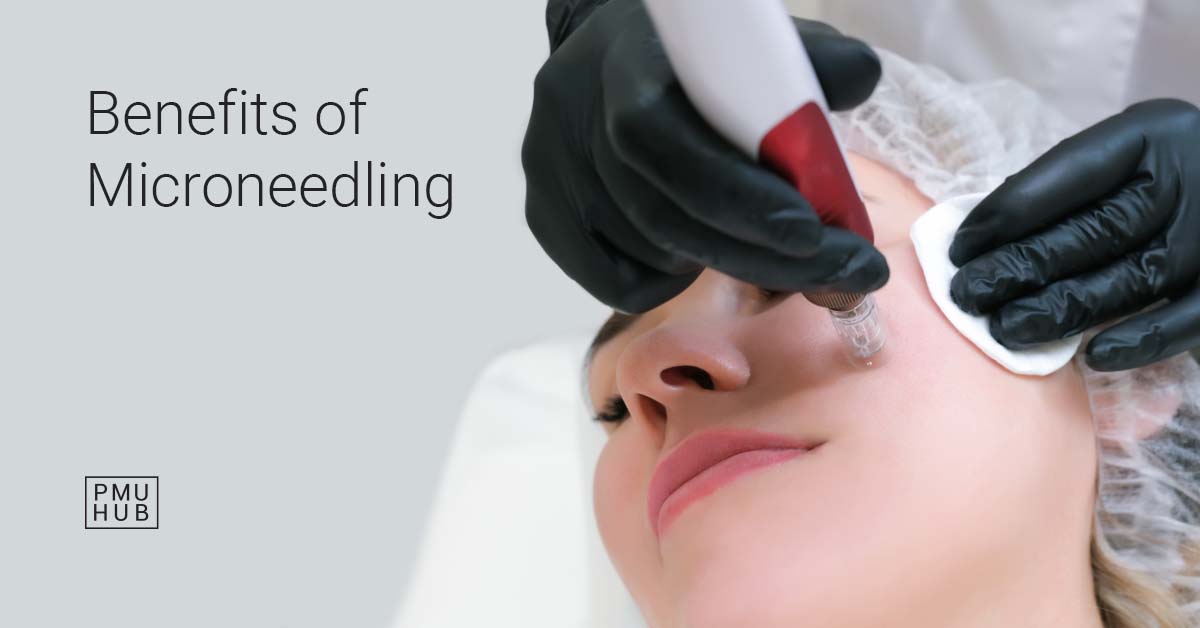 Microneedling Benefits - Why Microneedling Is a Great Treatment