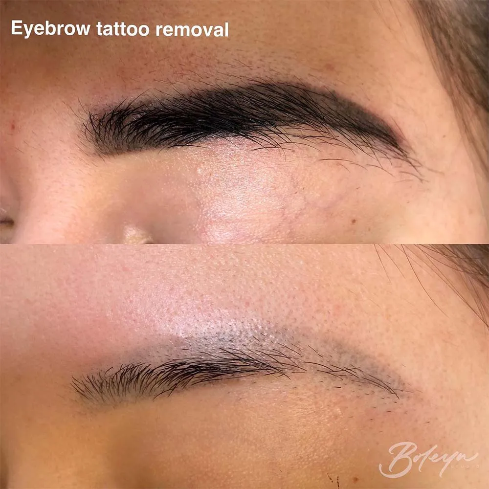 Ombre Brows Gone Wrong - Eyebrows Are Too Dark