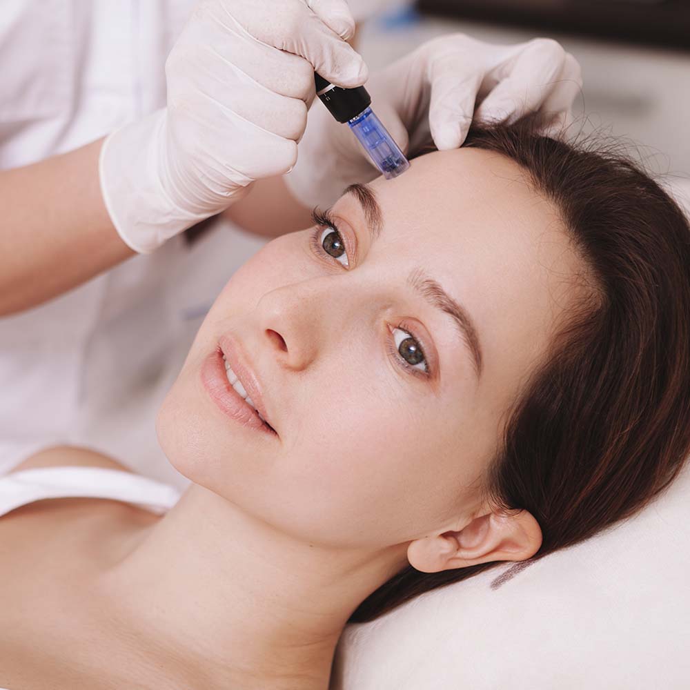 Is a Professional Service Better than Microneedling Brows at Home?