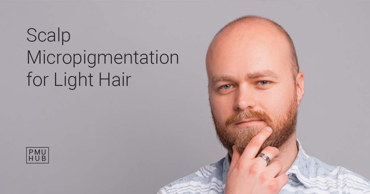 Can I Get Scalp Micropigmentation for Fair Hair? SMP for Blondes