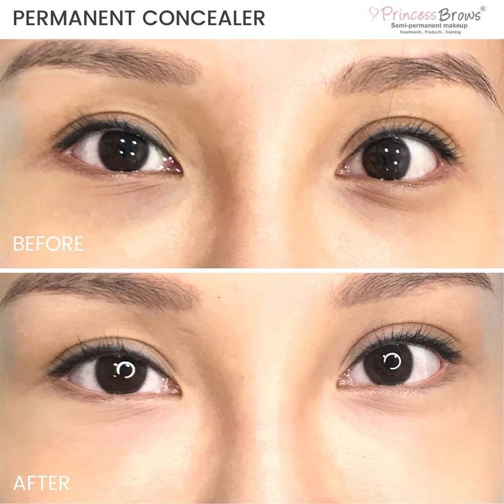 Under Eye Concealer Tattoo - Does It Work and Is It Safe? Under Eye Concealer Tattoo - Does It Work and Is It Safe?