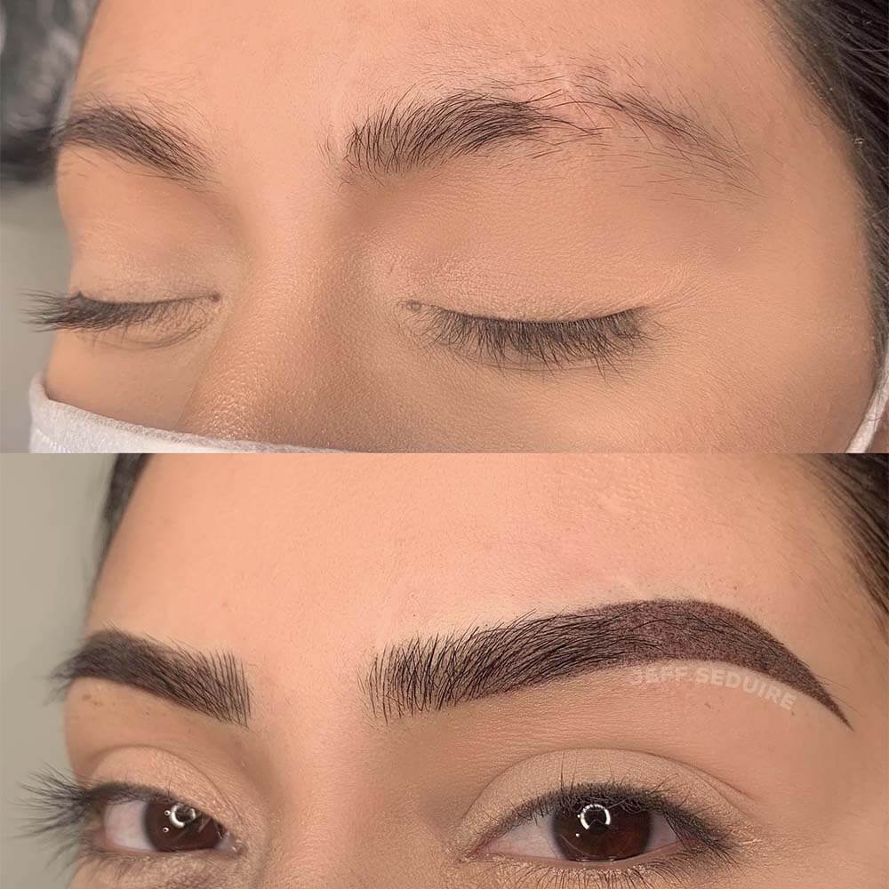 doing microblading over scar