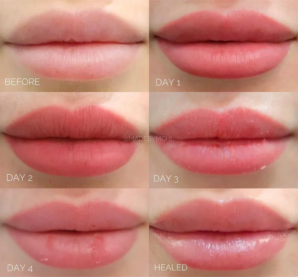 Permanent Lip Color Healing Process: Everything You Need to Know