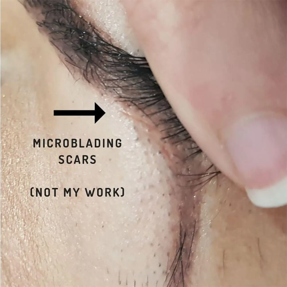 microblading scars
