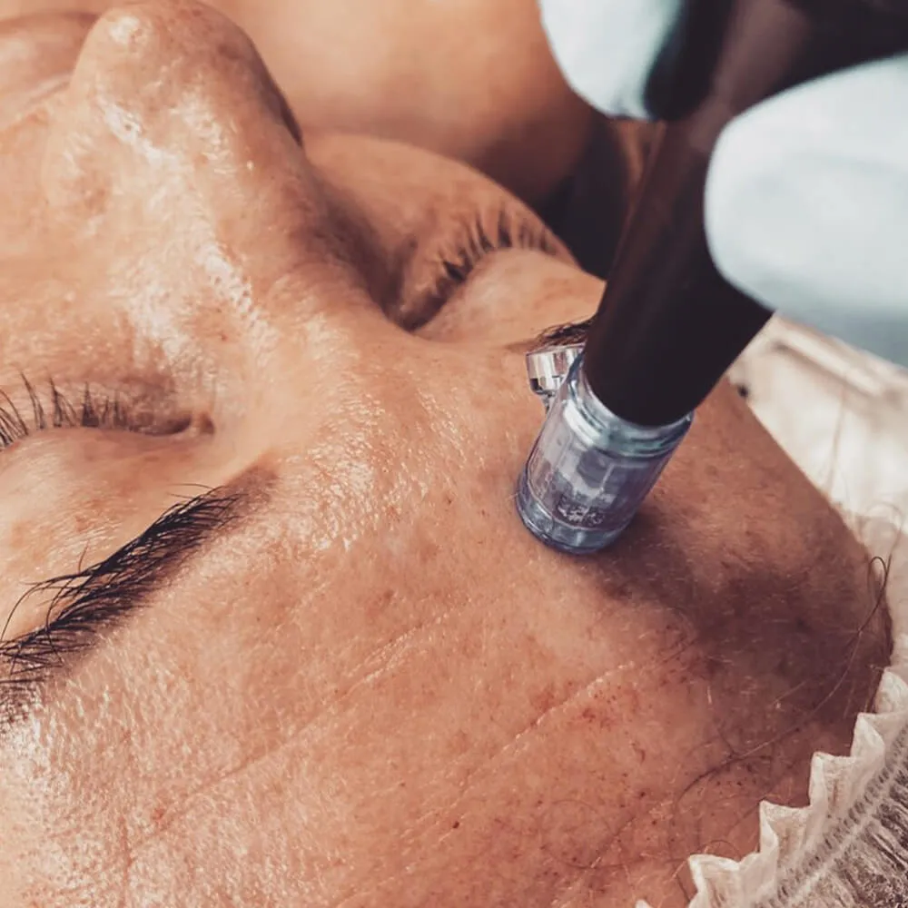 microneedling aftercare necessity