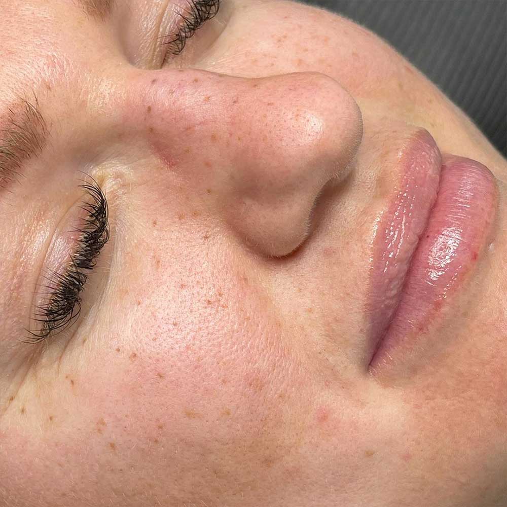 how healed freckle tattoos look like on face