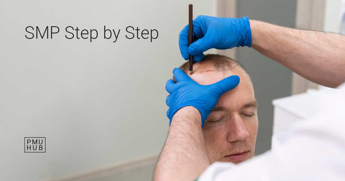 SMP Procedure - Scalp Micropigmentation Step by Step