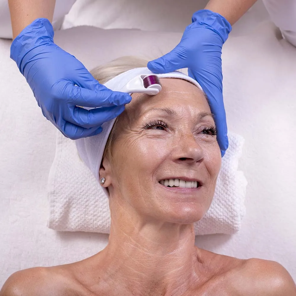 derma roller microneedling