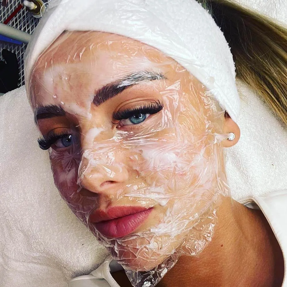 numbing cream for microneedling