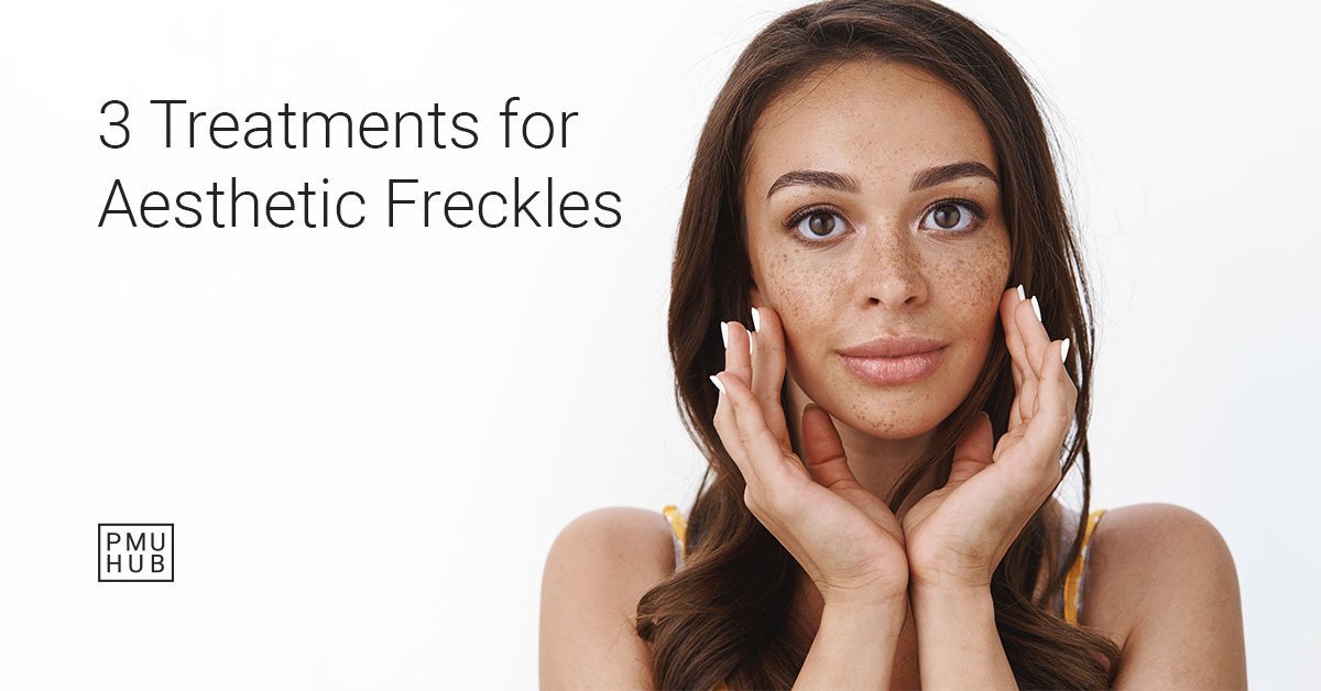 Three methods for aesthetic freckles