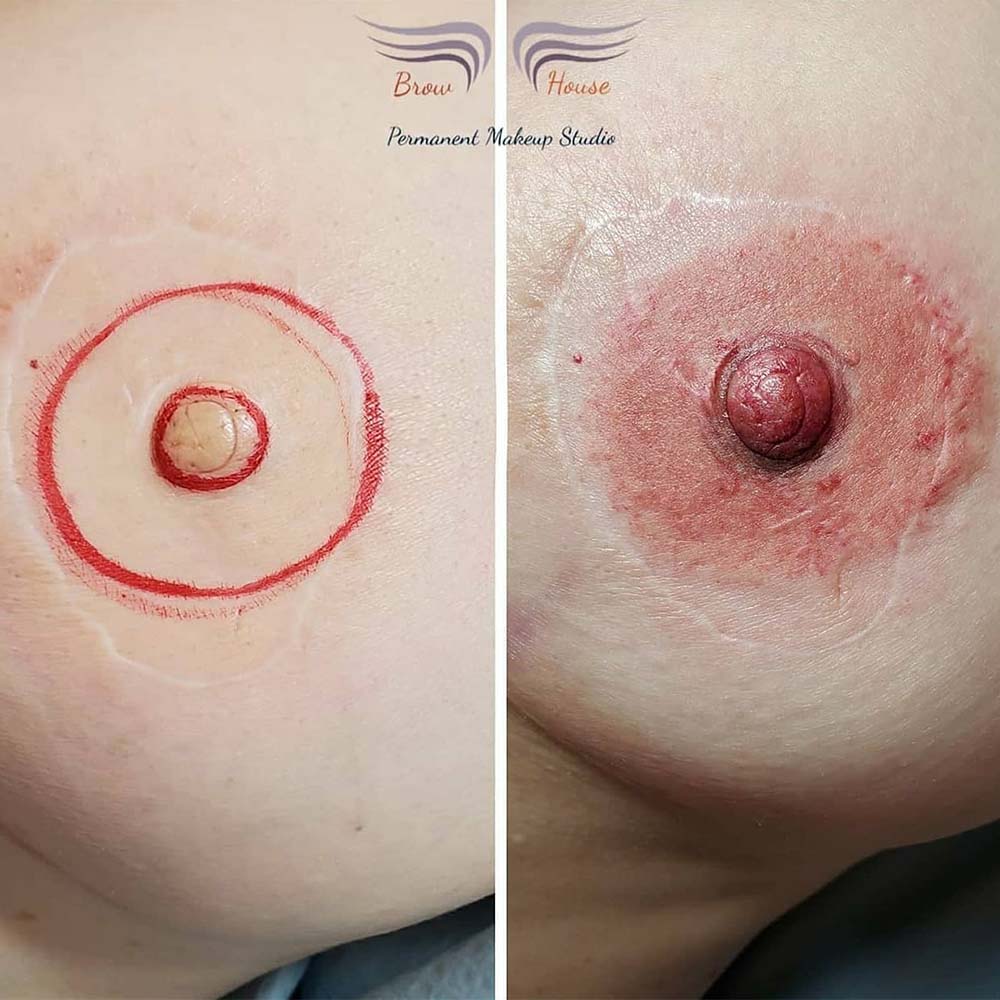 How To Heal Tattoos on Breasts: Nipple and Areola Tattoo
