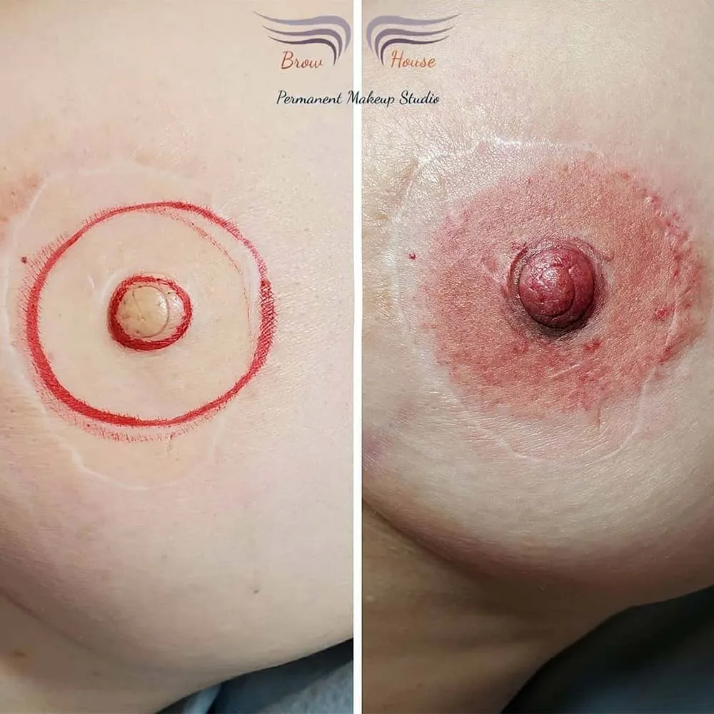How To Heal Tattoos on Breasts: Nipple and Areola Tattoo How To Heal Tattoos on Breasts: Nipple and Areola Tattoo