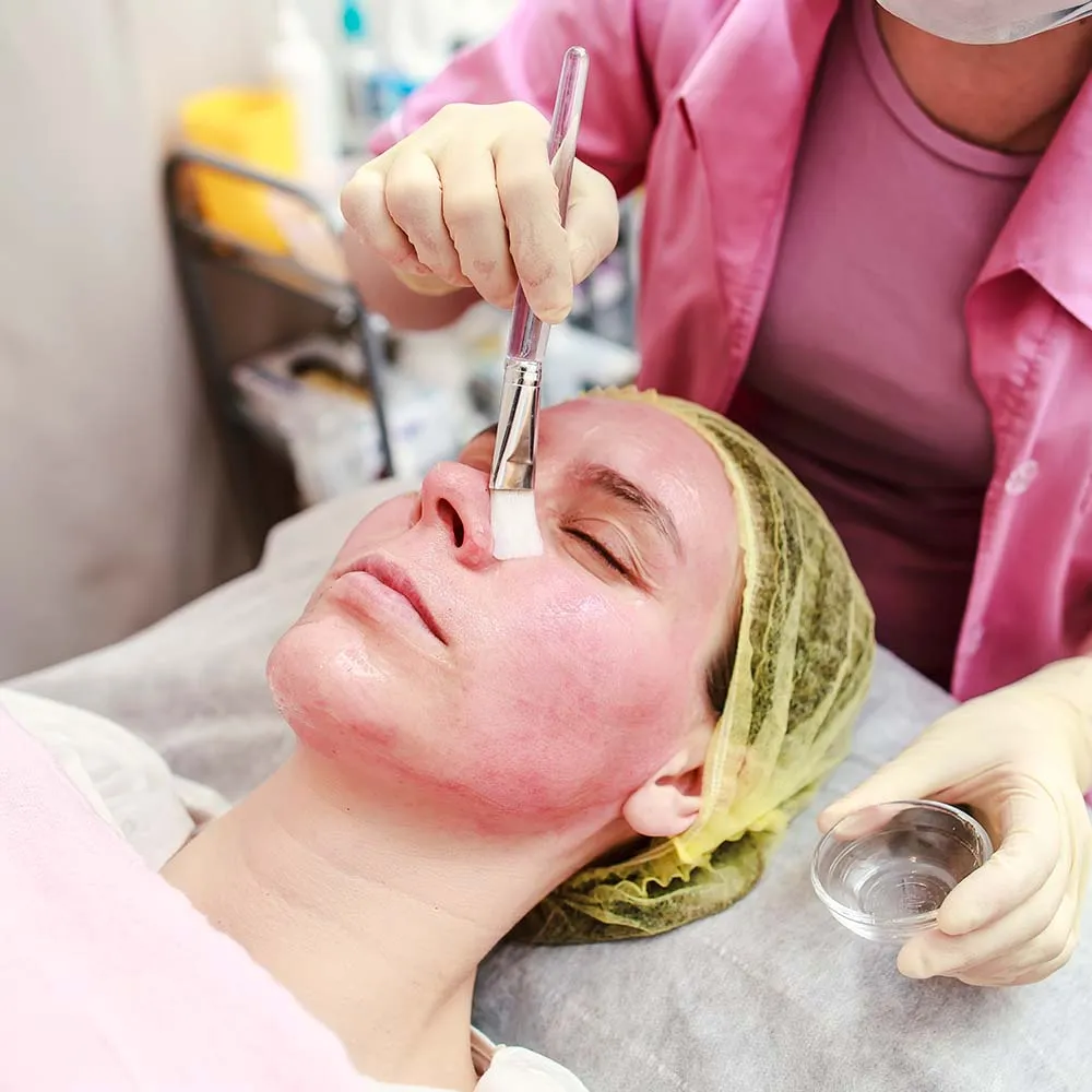 Woman getting a chemical peel