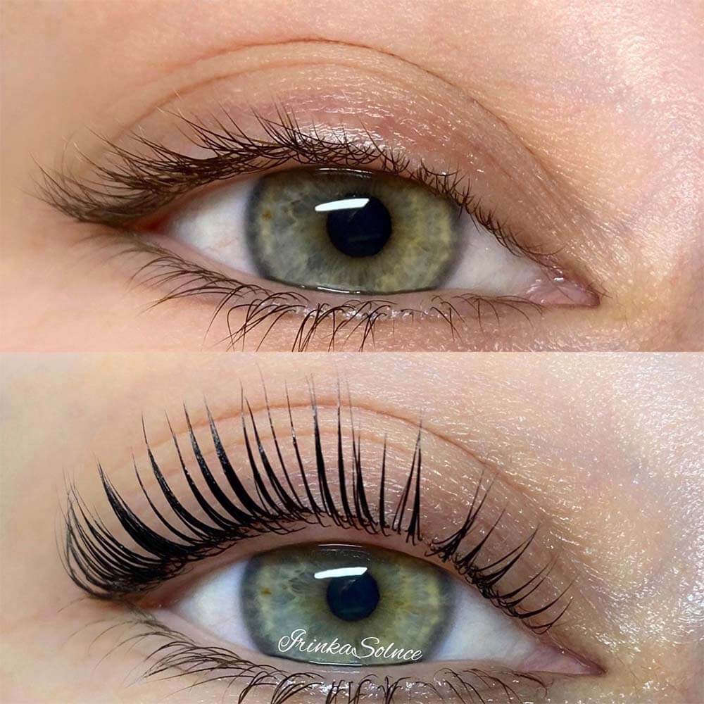 Results of a lash lift