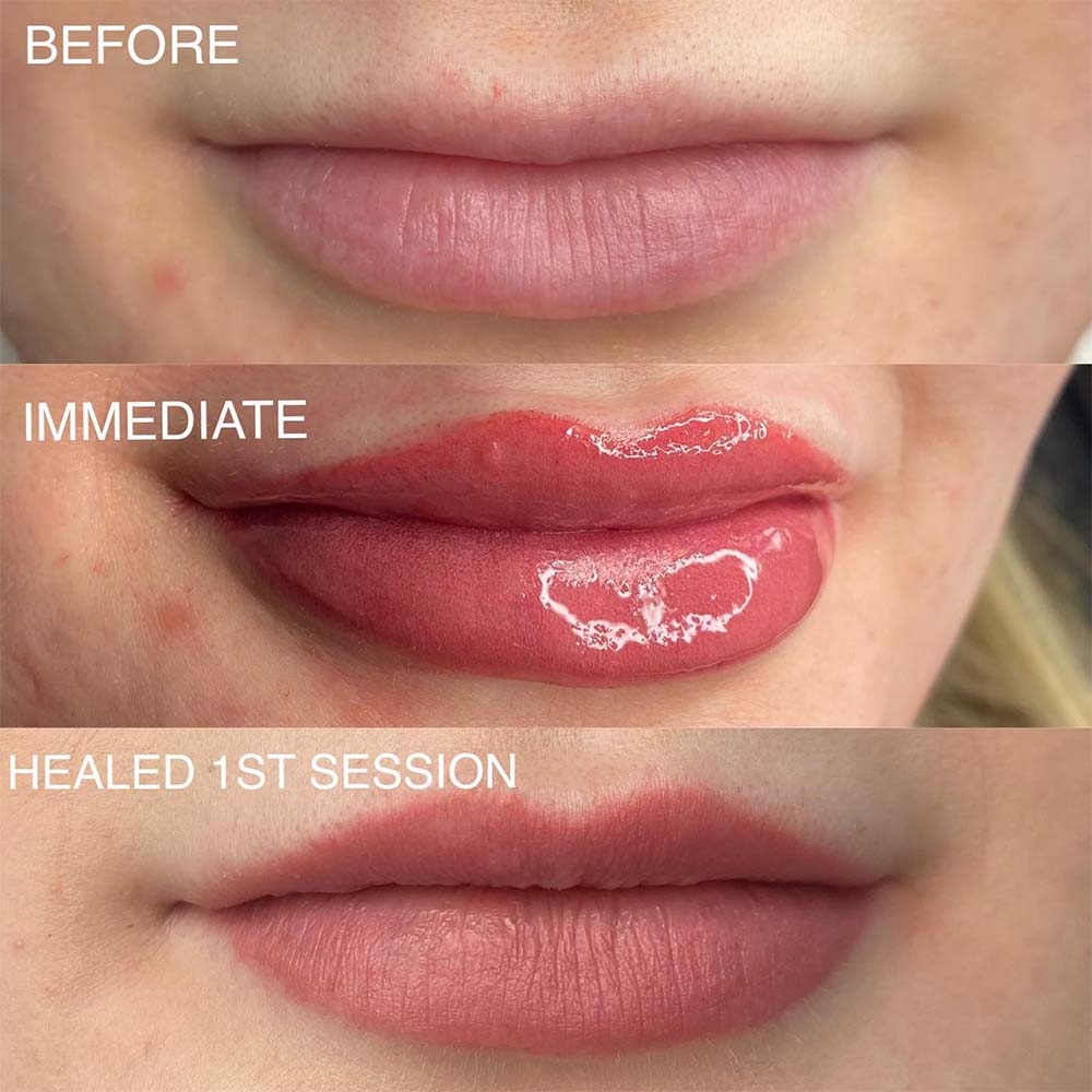 healed lips after lip blushing