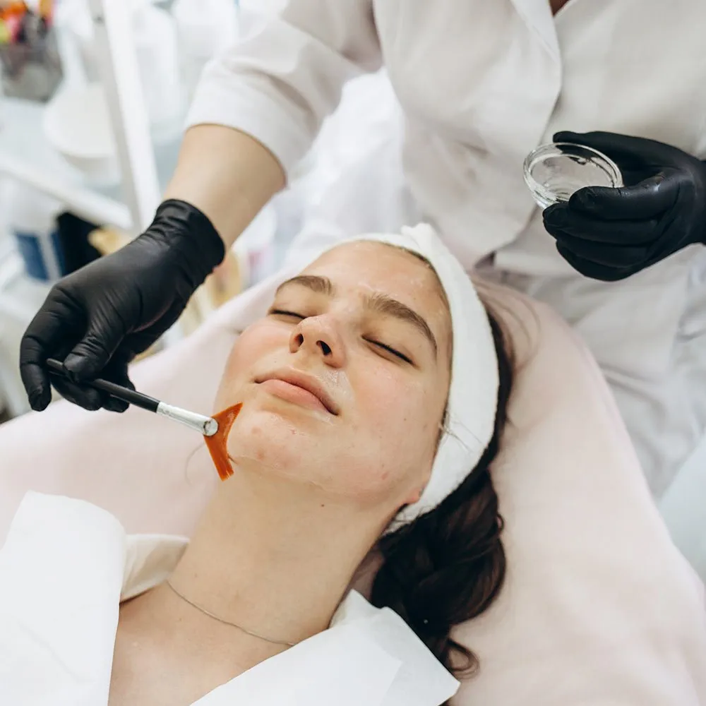 how do chemical peels work