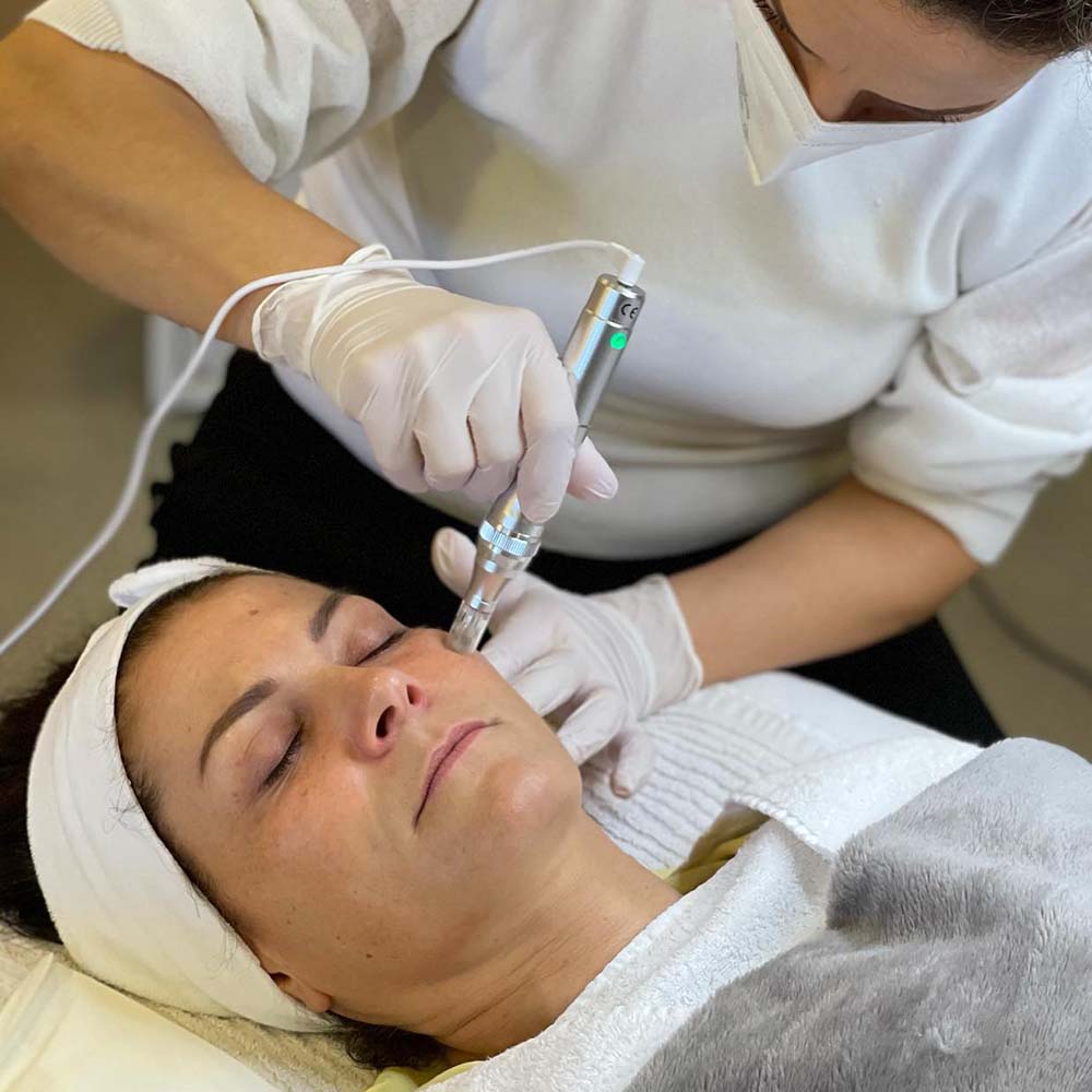 is microneedling expensive?