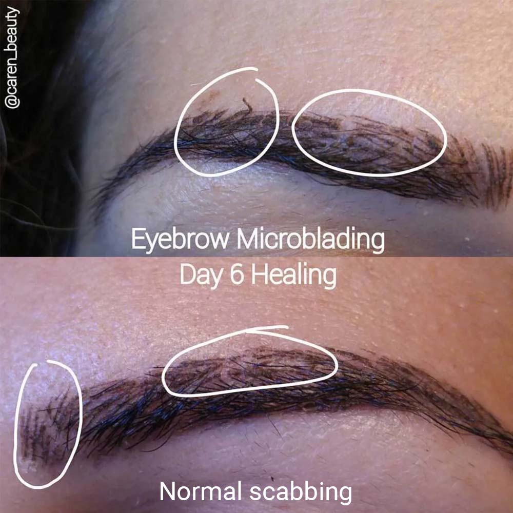 does microblading stop hair growth