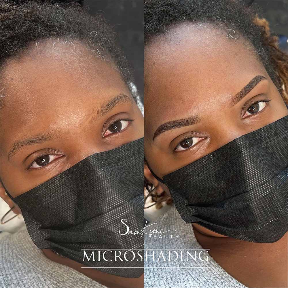 Eyebrow scar camouflage with powder brows