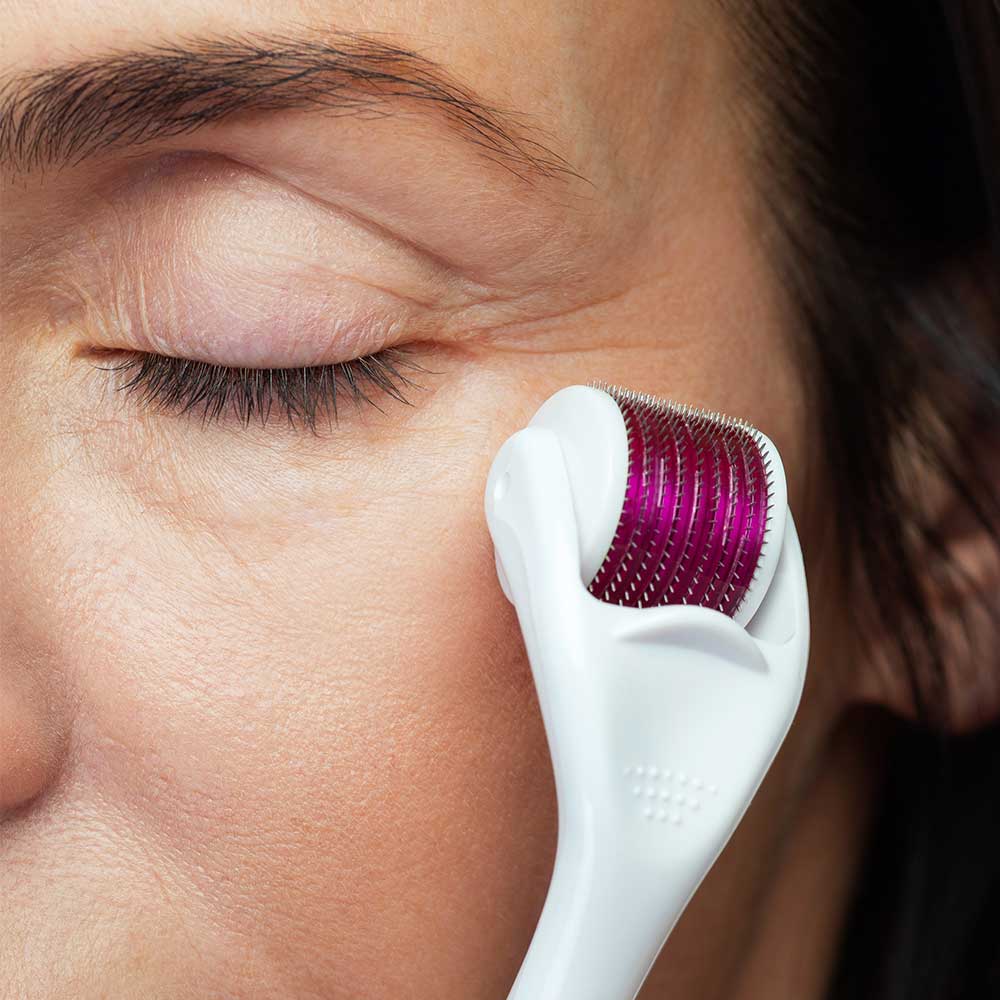Woman using the derma roller