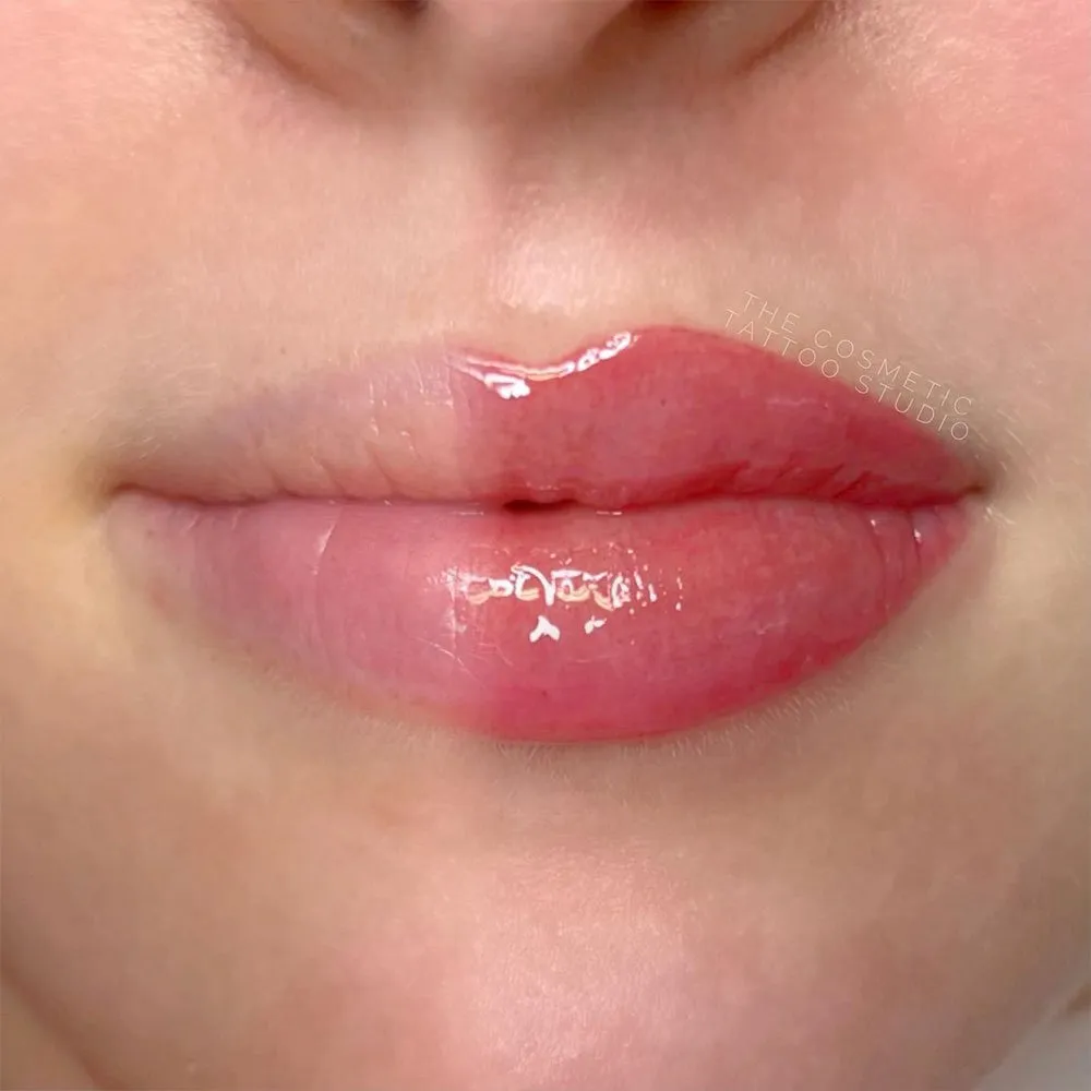 microneedling lips alternative solutions