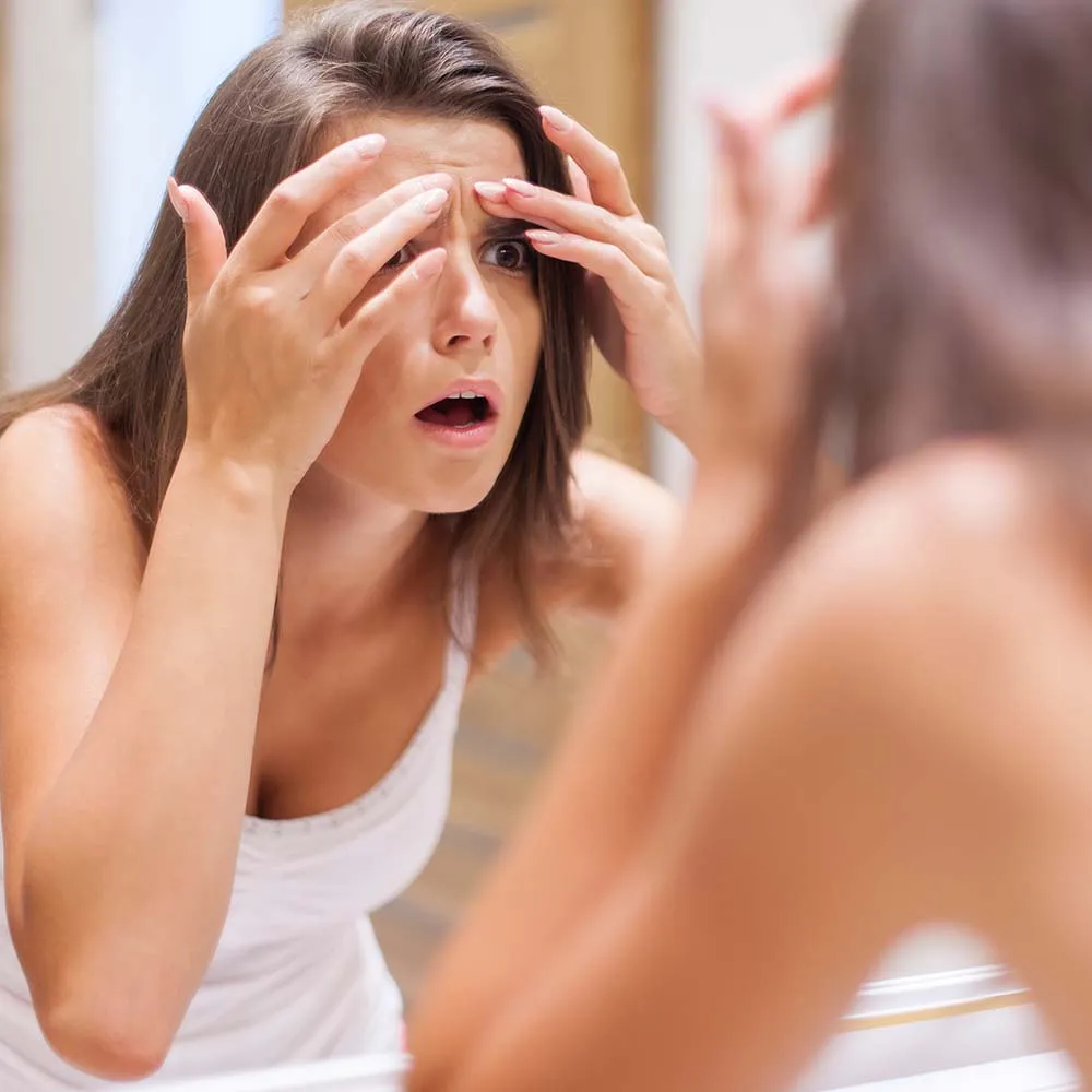 chance of acne breakout after dermaplaning
