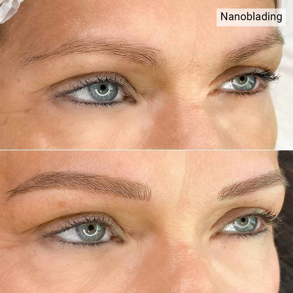 Difference Between Nanoblading and Microblading Aftercare